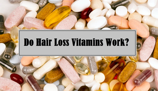 Hair Loss Vitamins? Do They Work?